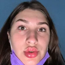 ДИАНА РУЛИТ