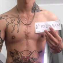 че по шрамам