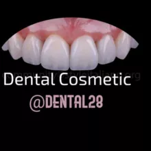 Dental cosmetic