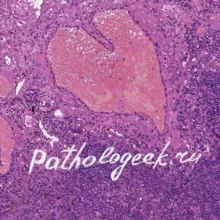 Pathologeek