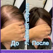 Tukilgan sochlarni qayta tiklash