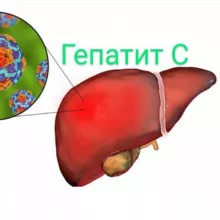 Гепатит С